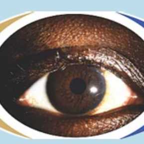 Ladkem Eye