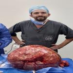Senior Consultant and Professor (a) of Surgical Oncology at National Cancer Institute-Cairo University.