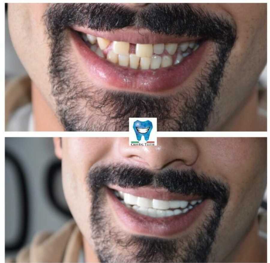 Clinic Crystal Teeth of Italy Dentist