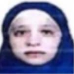 Consultant Ophthalmologist surgeon 