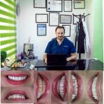 تجميل الاسنان