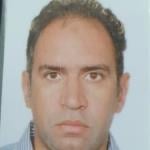 Consultant of Vascular Surgery Consultant of Vascular Surgery