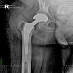 اخصائى طب وجراحات العظام والكسور والمناظير والمفاصل الصناعيه